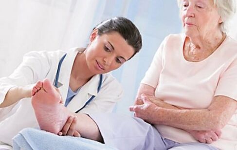 Shikimi i mjekut nëse keni simptoma të venave me variçe